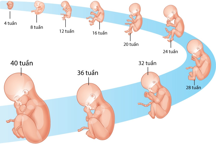 Việc chăm sóc trẻ được sinh ra từ người mẹ bị rối loạn chuyển hóa glucose cần chú ý đặc biệt gì? 1